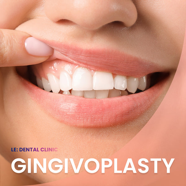 Gingivoplasty (Surgical / per tooth)